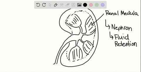 diuretic-drugs-prevent-ions-from-being-reabsorbed-from-the-nephron-explain-why-a-diuretic-drug-might