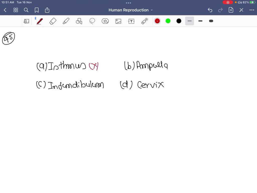 SOLVEDThe funnel shaped part of fallopian tube which traps ovum is