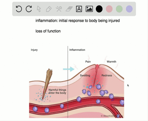 which-of-the-following-processes-is-not-a-cardinal-sign-of-inflammation-a-redness-b-heat-c-fever-d-s