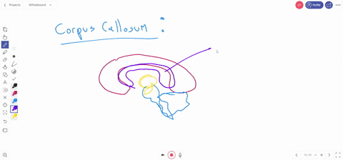 the-corpus-callosum-serves-as-the-connection-between-the-a-thalamus-and-hypothalamus-b-mesencephalon