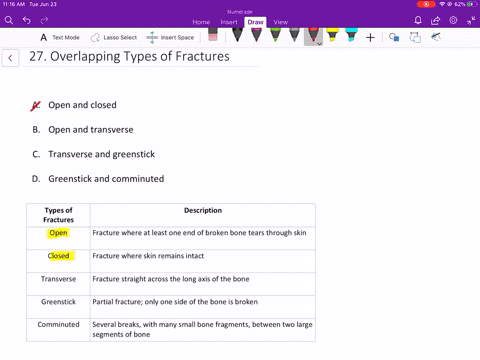 a-fracture-can-be-both-______-a-open-and-closed-b-open-and-transverse-c-transverse-and-greenstick-d-