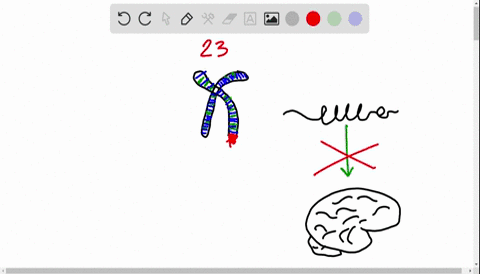 dr-thomas-has-found-that-william-her-patient-has-a-defect-in-a-gene-on-the-x-chromosome-of-his-23-rd
