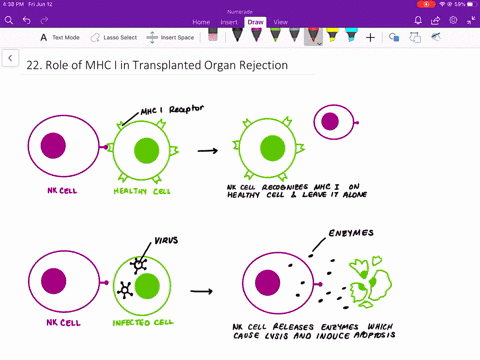 different-mhc-i-molecules-between-donor-and-recipient-cells-can-lead-to-rejection-of-a-transplanted-