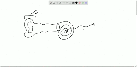 figure-3614-cochlear-implants-can-restore-hearing-in-people-who-have-a-nonfunctional-cochlea-the-imp
