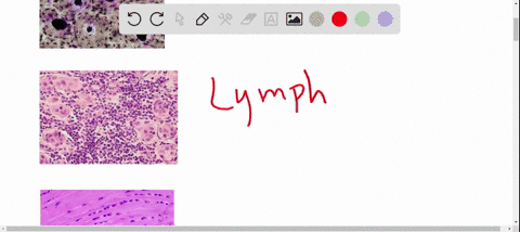 the-type-of-connective-tissue-illustrated-below-is-a-bone-d-lymph-b-hyaline-cartilage-e-fibrocartila